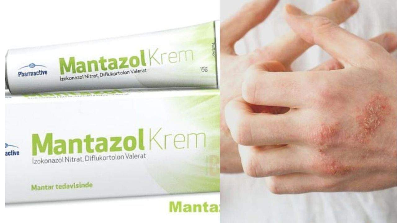 mantazol-krem.jpg